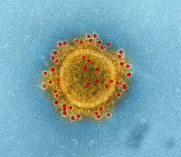 유산균 박테리아 사진